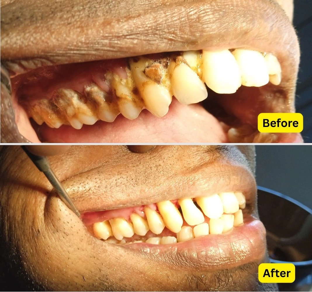 Dental Check-Up